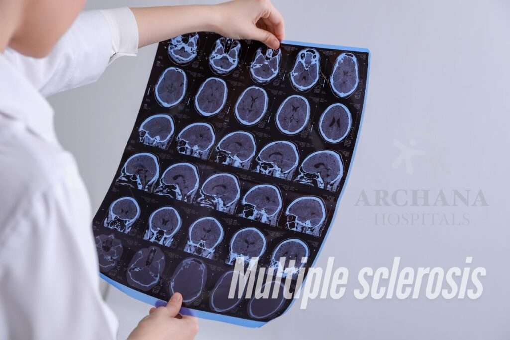 Multiple sclerosis treatment