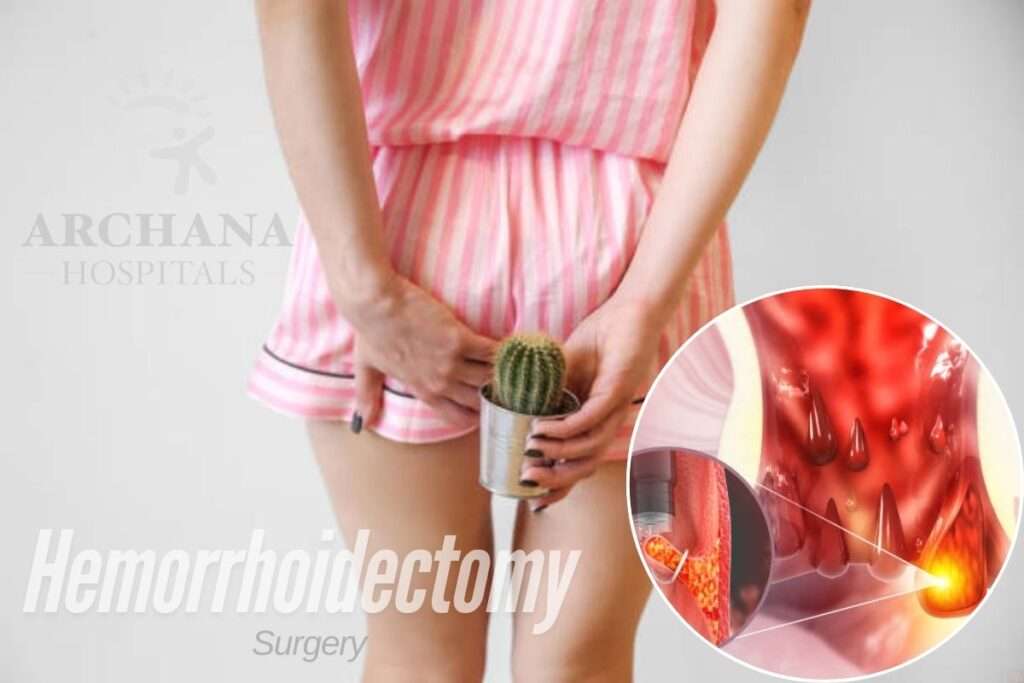 hemorrhoidectomy treatment