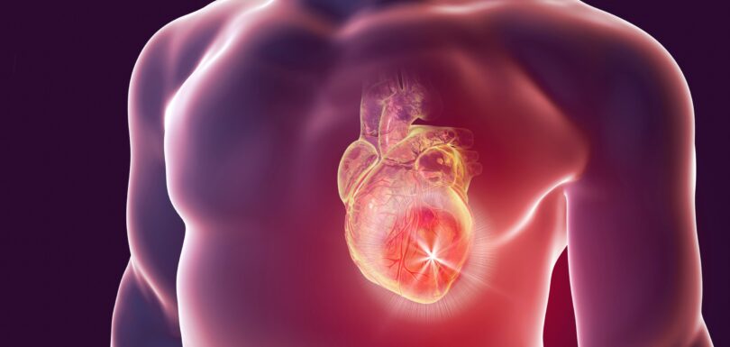 Heart disease and chest pain treatment in Hyderabad at Archana Hospitals cardiology department